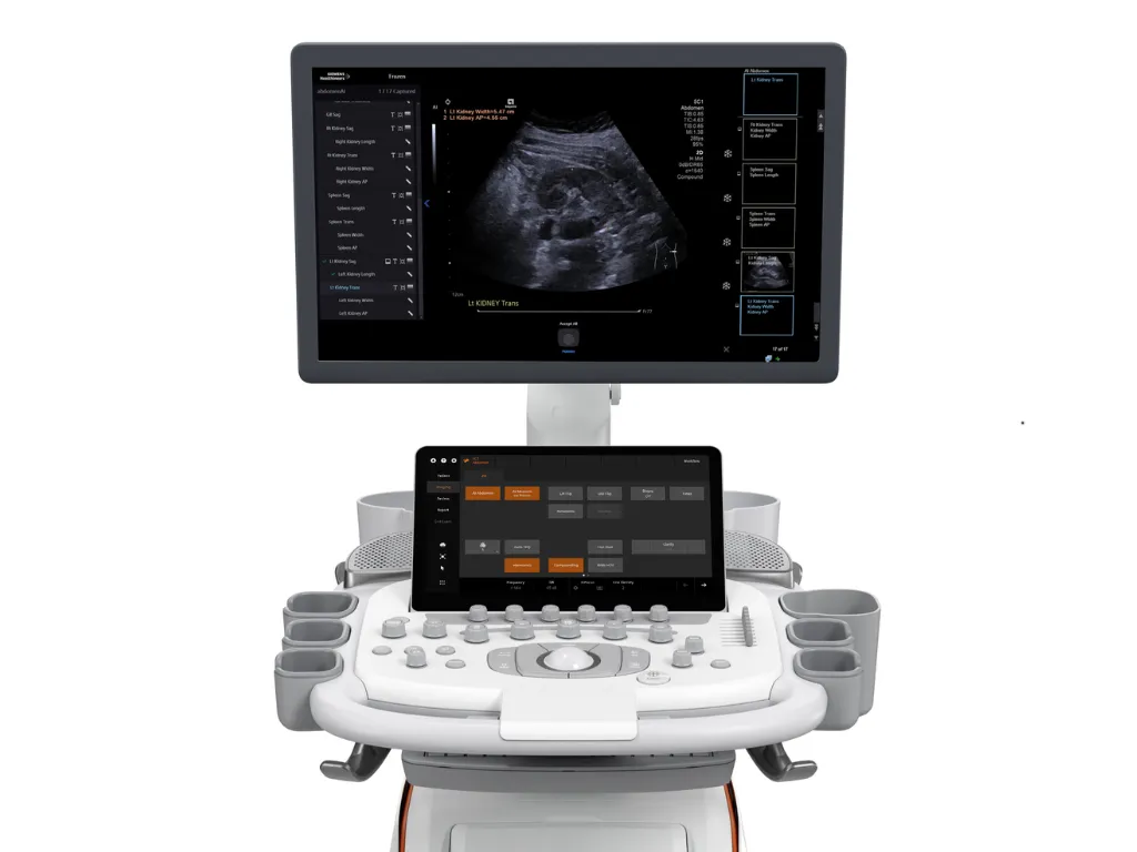 SIEMENS Acuson Sequoia
