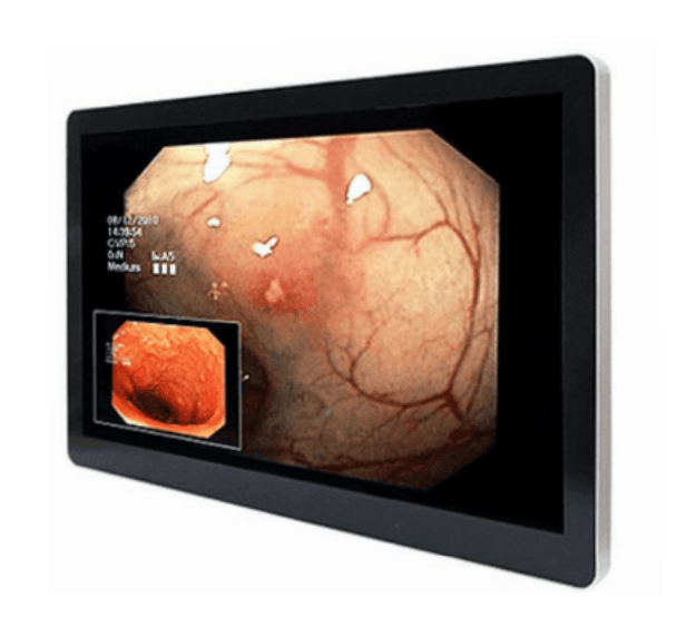 ENDOMED Endoscopic Monitor ENM-20